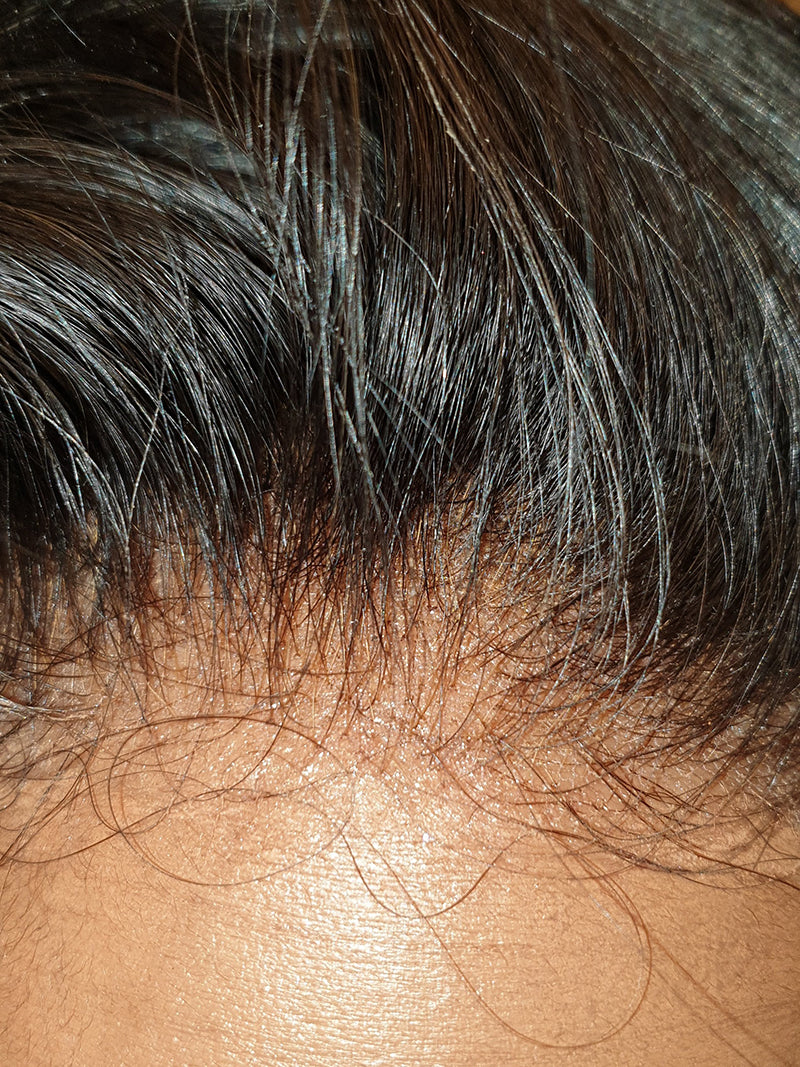 Straight HD Frontal