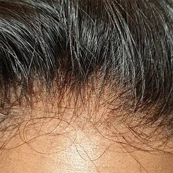 JAYE HD Laceclosure Burmese curly wig 200% density